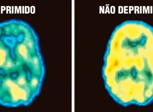 depressed1-696x365-1